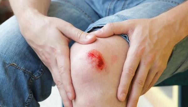 زخم باز چیست و چگونه درمان میشود؟