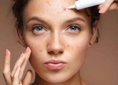 پماد پانژل برای چیست و چه کاربردها، عوارض و نحوه مصرفی دارد؟